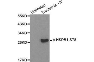 Western blot analysis of extracts from HL60 cells, using Phospho-HSPB1-S78 antibody. (HSP27 anticorps  (pSer78))