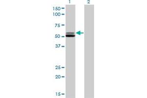 Western Blot analysis of GSR expression in transfected 293T cell line by GSR monoclonal antibody (M01), clone 6B4.