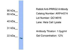 WB Suggested Anti-PRRG2  Antibody Titration: 0.