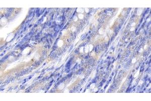 anti-Interleukin 10 (IL10) (AA 21-181) antibody