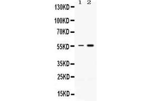 Western blot analysis of MEF2A expression in rat thymus extract ( Lane 1) and HELA whole cell lysates ( Lane 2). (MEF2A anticorps  (C-Term))