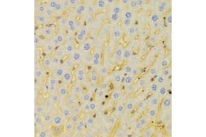 Immunohistochemistry of paraffin-embedded Mouse liver using PCM1 antibody at dilution of 1:100 (x400 lens). (PCM1 anticorps)