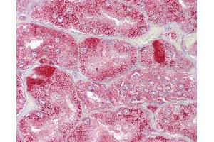 Anti-AMACR antibody IHC of human kidney.