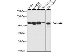 Western blot analysis of extracts of various cell lines, using COLEC12 antibody (ABIN4903342) at 1:2000 dilution. (COLEC12 anticorps)