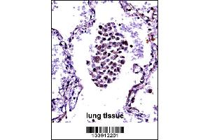 NFKBIB Antibody immunohistochemistry analysis in formalin fixed and paraffin embedded human lung tissue followed by peroxidase conjugation of the secondary antibody and DAB staining. (NFKBIB anticorps  (C-Term))