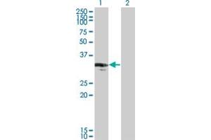 Western Blot analysis of CENPP expression in transfected 293T cell line by CENPP monoclonal antibody (M07), clone 3G8. (CENPP anticorps  (AA 1-98))