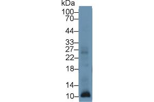 Western blot analysis of Human Leukocyte lysate, using Human S100A12 Antibody (1 µg/ml) and HRP-conjugated Goat Anti-Rabbit antibody ( (S100A12 anticorps  (AA 1-92))