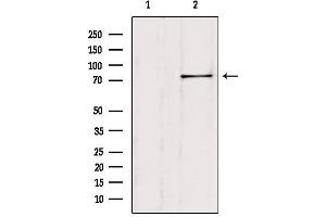 Western blot analysis of extracts from Hela, using SH2B1 Antibody. (SH2B1 anticorps  (Internal Region))