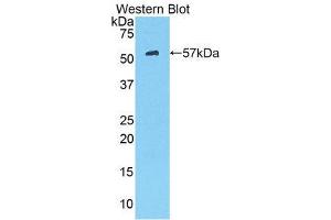 Western Blotting (WB) image for anti-Hexokinase 2 (HK2) (AA 605-868) antibody (ABIN1859175) (Hexokinase 2 anticorps  (AA 605-868))