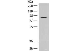 Western blot analysis of Mouse brain tissue lysate using PFKM Polyclonal Antibody at dilution of 1:350 (PFKM anticorps)