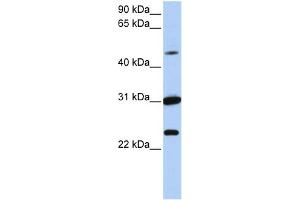 WB Suggested Anti-XK Antibody Titration:  0. (Membrane transport protein XK (XK) (N-Term) anticorps)