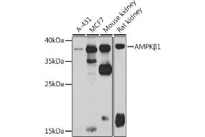 Western blot analysis of extracts of various cell lines, using AMPKβ1 antibody (ABIN6134216, ABIN6146175, ABIN6146177 and ABIN6223916) at 1:1000 dilution. (PRKAB1 anticorps)