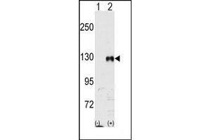 Western blot analysis of EphB1 (arrow) using rabbit polyclonal EphB1 Antibody. (EPH Receptor B1 anticorps)