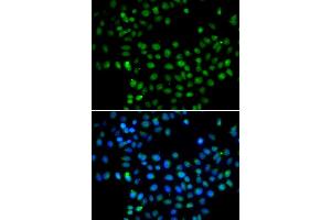 Immunofluorescence analysis of A549 cells using EAF2 antibody (ABIN5974281). (EAF2 anticorps)