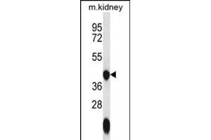 GTPBP10 Antibody (C-term) (ABIN656643 and ABIN2845886) western blot analysis in mouse kidney tissue lysates (35 μg/lane). (GTPBP10 anticorps  (C-Term))