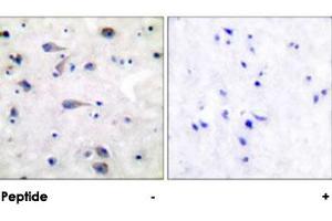 Immunohistochemical analysis of paraffin-embedded human brain tissue using OPRM1 polyclonal antibody . (Mu Opioid Receptor 1 anticorps)