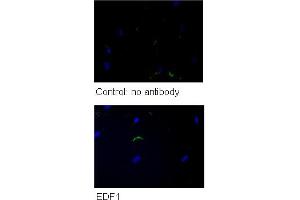 WB Suggested Anti-GPD1 Antibody    Titration: 5 ug/ml   Positive Control: HG (EDF1 anticorps  (N-Term))