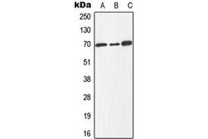 Western blot analysis of E2F1 (pT433) expression in Jurkat colchicine-treated (A), mouse spleen (B), PC12 colchicine-treated (C) whole cell lysates. (E2F1 anticorps  (C-Term, pSer433))