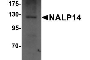 Western blot analysis of NALP14 in rat brain tissue lysate with NALP14 antibody at 1 µg/mL. (NLRP14 anticorps  (N-Term))