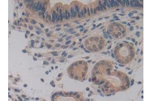 Detection of PDHX in Mouse Uterus Tissue using Polyclonal Antibody to Pyruvate Dehydrogenase Complex Component X (PDHX) (PDHX anticorps  (AA 222-471))