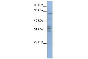 CENPB antibody used at 1 ug/ml to detect target protein. (CENPB anticorps  (C-Term))