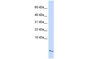 WB Suggested Anti-SAA4 Antibody Titration:  0. (SAA4 anticorps  (Middle Region))