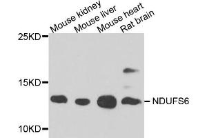 Western blot analysis of extract of various cells, using NDUFS6 antibody. (NDUFS6 anticorps)