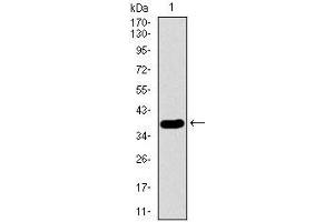 Western blot analysis using SFTPC mAb against human SFTPC recombinant protein. (Surfactant Protein C anticorps  (AA 60-180))
