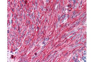 Anti-CD44 antibody IHC of human uterus, smooth muscle.