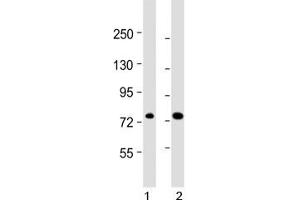 ABCD1 antibody western blot analysis in human 1) 293/T17 and 2) HL-60 lysate. (ABCD1 anticorps  (AA 257-285))