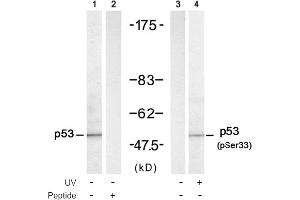 Image no. 1 for anti-Tumor Protein P53 (TP53) (Ser33) antibody (ABIN319306) (p53 anticorps  (Ser33))
