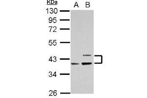 WB Image Sample (30 ug of whole cell lysate) A: Raji B: K562 10% SDS PAGE antibody diluted at 1:1000 (APOL1 anticorps)