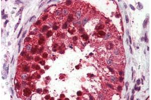 Testis, Human: Formalin-Fixed, Paraffin-Embedded (FFPE) (USP2 anticorps  (C-Term))