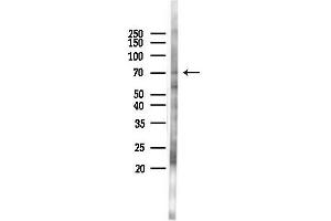 anti-CXXC Finger Protein 1 (CXXC1) antibody