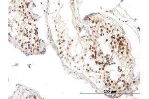 Immunoperoxidase of purified MaxPab antibody to RAD51 on formalin-fixed paraffin-embedded human testis.
