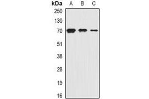 Western blot analysis of PiT2 expression in HepG2 (A), mouse kidney (B), rat liver (C) whole cell lysates. (SLC20A2 anticorps)