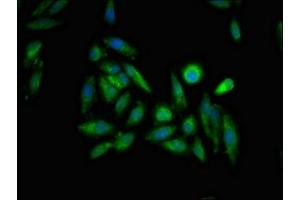Immunofluorescent analysis of Hela cells using ABIN7156293 at dilution of 1:100 and Alexa Fluor 488-congugated AffiniPure Goat Anti-Rabbit IgG(H+L) (ITPR1 anticorps  (AA 1707-1966))