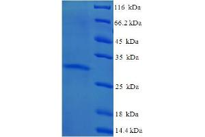 SDS-PAGE (SDS) image for Yippee-Like 3 (YPEL3) (AA 1-119), (full length) protein (His-SUMO Tag) (ABIN5710640) (YPEL3 Protein (AA 1-119, full length) (His-SUMO Tag))