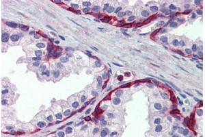 Human Prostate: Formalin-Fixed, Paraffin-Embedded (FFPE) (METTL7A anticorps  (Internal Region))
