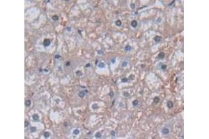 IHC-P analysis of Human Tissue, with DAB staining. (GGT1 anticorps  (AA 122-299))