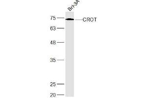 Brl-3A lysates probed with CROT Polyclonal Antibody, Unconjugated  at 1:300 dilution and 4˚C overnight incubation. (CROT anticorps  (AA 201-275))