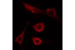 ABIN6274492 staining Hela cells by IF/ICC. (C1orf35 anticorps  (C-Term))