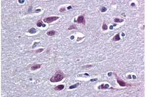 Human Brain, Cortex: Formalin-Fixed, Paraffin-Embedded (FFPE) (RBM9 anticorps  (AA 1-100))