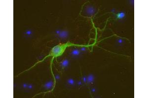 anti-F-Box Protein 41 (FBXO41) (AA 130-143) antibody