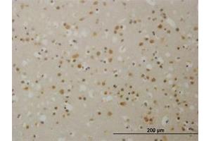 Image no. 1 for anti-Transducin (Beta)-Like 1X-Linked (TBL1X) (AA 478-578) antibody (ABIN598960) (TBL1X anticorps  (AA 478-578))
