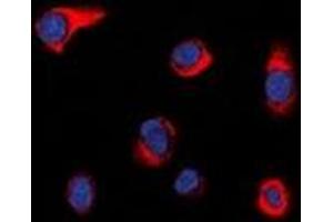 Immunofluorescent analysis of PIP5K staining in HepG2 cells.