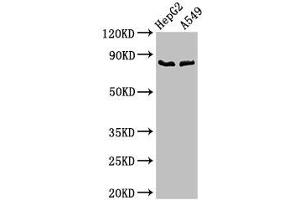 Western Blot Positive WB detected in: HepG2 whole cell lysate, A549 whole cell lysate All lanes: CFB antibody at 2. (Complement Factor B anticorps  (AA 23-761))