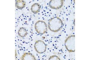 Immunohistochemistry of paraffin-embedded human stomach using C antibody (ABIN6129635, ABIN6137807, ABIN6137808 and ABIN6217796) at dilution of 1:100 (40x lens).