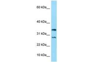 Image no. 1 for anti-NADH Dehydrogenase (Ubiquinone) 1 alpha Subcomplex, 11, 14.7kDa (NDUFA11) (AA 15-64) antibody (ABIN6748211) (NDUFA11 anticorps  (AA 15-64))