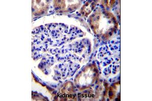 RICTOR Antibody (C-term) (ABIN391385 and ABIN2841393) immunohistochemistry analysis in formalin fixed and paraffin embedded human kidney tissue followed by peroxidase conjugation of the secondary antibody and DAB staining. (RICTOR anticorps  (C-Term))